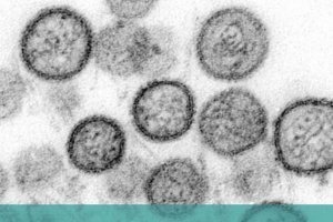 CABECERA-Hantavirus CABECERA-Hantavirus